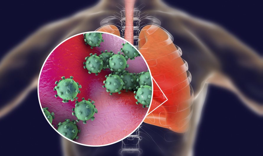 Как развивается пневмония при коронавирусе?