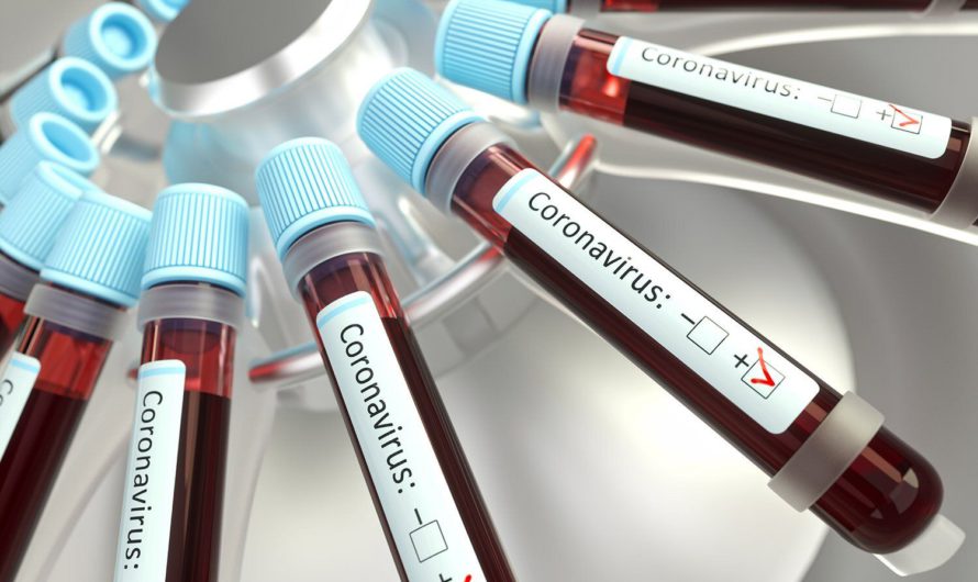 Тест на коронавирус и почему это важно